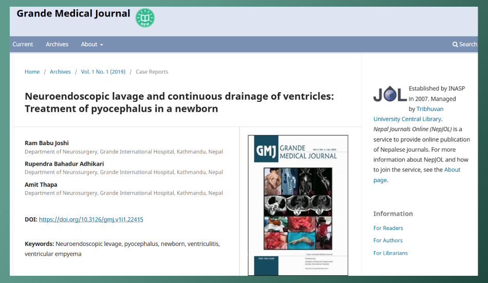 Neuroendoscopic lavage and continuous drainage of ventricles: Treatment of pyocephalus in a newborn